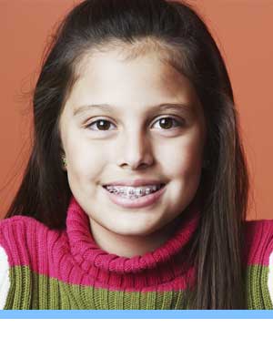 Early Treatment girl braces Elite Orthodontics San Diego CA