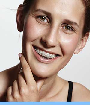 Damon Braces interior photo young woman braces Elite Orthodontics San Diego CA