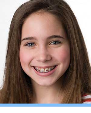 Patient Forms interior photo girl braces Elite Orthodontics San Diego CA