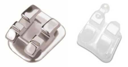3M Braces Bracket Elite Orthodontics San Diego CA